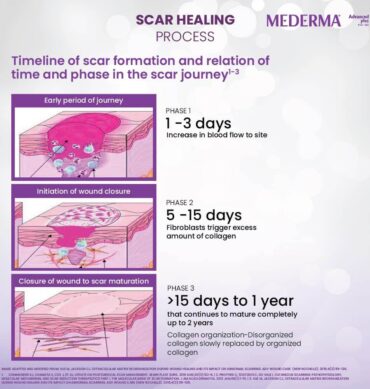 Mederma Advanced Plus Scar Gel, Purple, 10 Gram