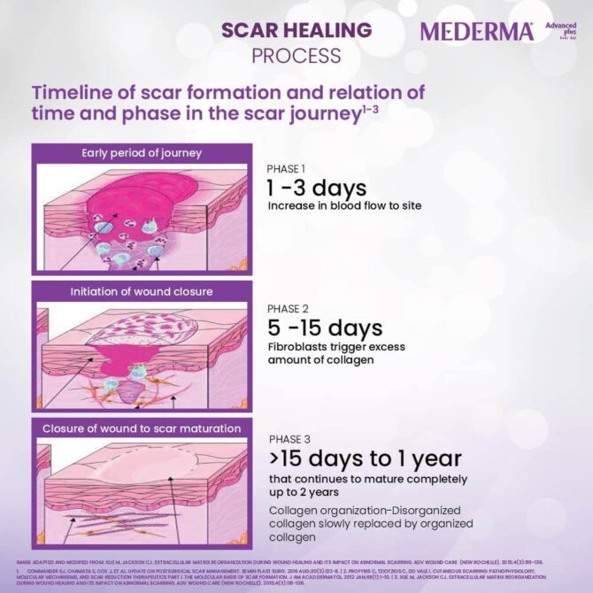 Mederma Advanced Plus Scar Gel, Purple, 10 Gram